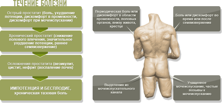 простатит у мужчин