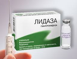 Нейрофиброматоз Реклингхаузена: симптомы, диагностика и лечение