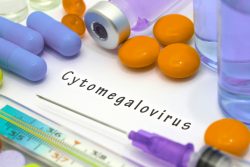 Лечение цитомегаловирусной инфекции